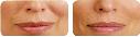 Before & After Photos